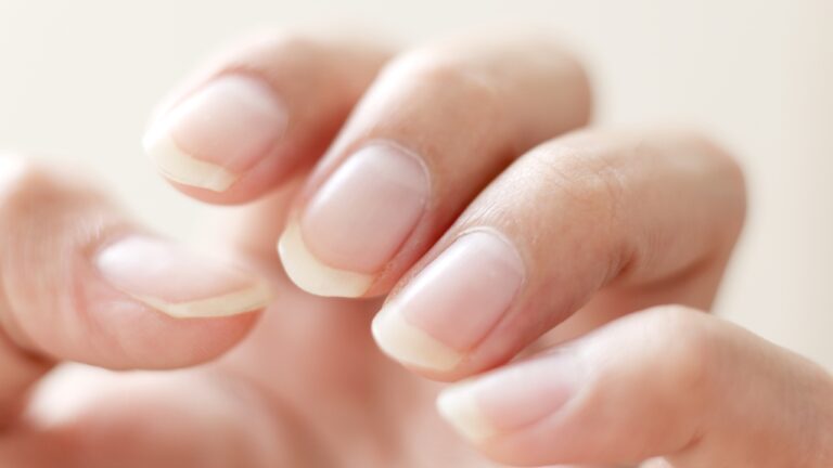 How To Remove Yellow Stains On Nails: 12 Ways